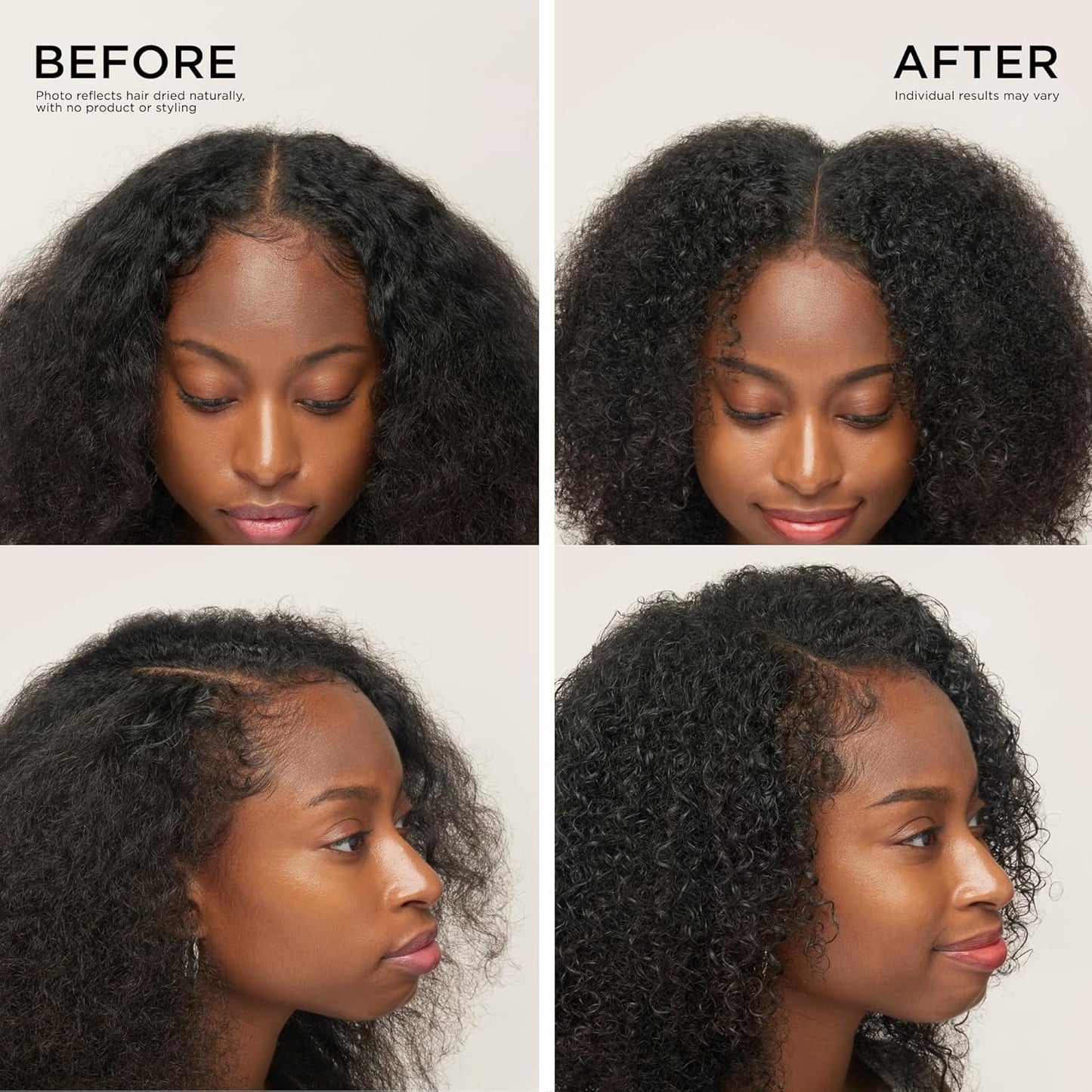 Award-Winning Hair Thickening Serum for Hair Loss, Thinning Hair, Korean Hair Care, Scalp Treatment, Clinically Tested, Thicker, Reduces Oil, Roll On