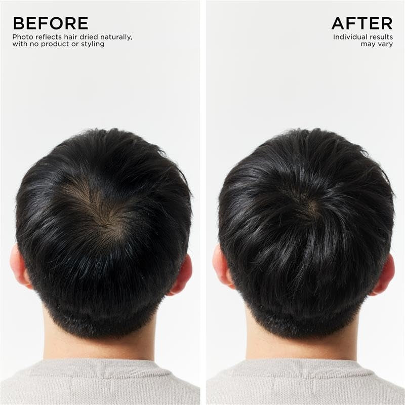 Hair Thickening Shampoo, Korean Hair Care with Biotin, Rosemary Oil to Help Volumize Thinning, Damaged Hair, Hydrate Hair and Scalp, Biotin Shampoo, Scalp Revitalizing Solution
