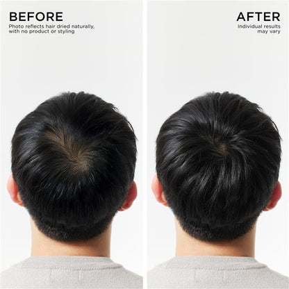 Hair Thickening Shampoo, Korean Hair Care with Biotin, Rosemary Oil to Help Volumize Thinning, Damaged Hair, Hydrate Hair and Scalp, Biotin Shampoo, Scalp Revitalizing Solution